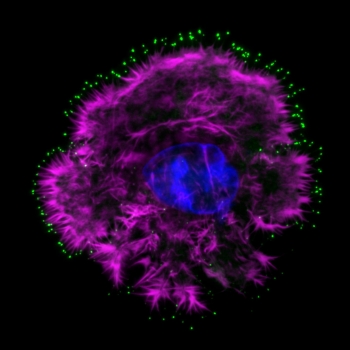 ▲유방암세포를 현미경으로 관찰한 모습. 초록색으로 형광 염색된 부분이 필로포디아(filopodia)이다.(제공: Dr Guillaume Jacquemet, University of Turku)
