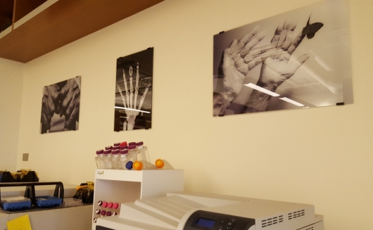 ▲휴미라 개발한 리차드 러너 박사 연구실 모습. 실험실 장비 위 벽면에는 관절염을 앓고 있는 환자들의 사진이 걸려있다.