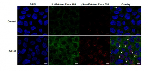 ▲PG102가 IL-37과 Smad3의 결합을 촉진. 피부 각질 세포에 PG102를 처리한 결과, IL-37의 발현량을 올리는 동시에 Smad3의 인산화를 유도하여 IL-37과 Smad3의 결합을 증가시킬 수 있음을 확인. 바이로메드 제공.