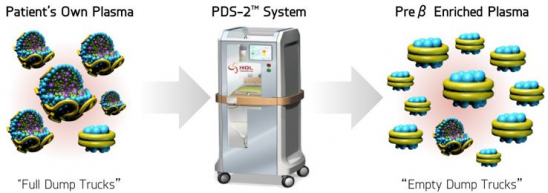 ▲PDS-2 시스템(에이치디엘 홈페이지 제공)
