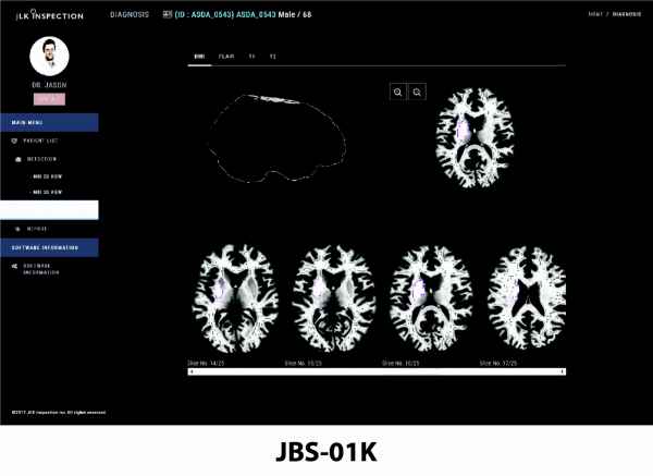 ▲인공지능 기반 뇌 MR 의료영상 분석 솔루션 JBS-01K 