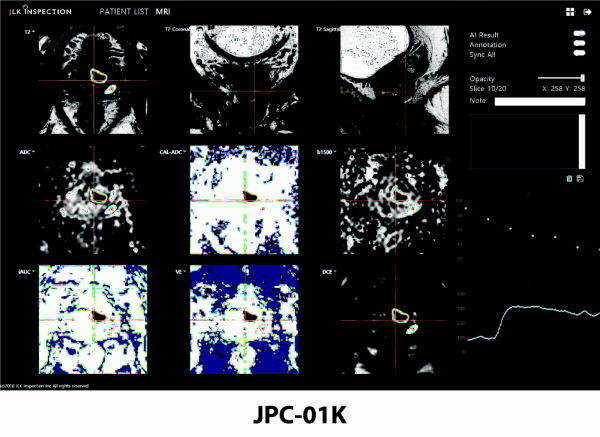 ▲인공지능 기반 전립선 MR 의료영상 분석 솔루션 JPC-01K 