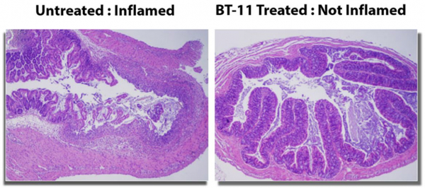 ▲BT-11 투여한 전임상시험 결과, BT-11 투여(오른쪽)로 염증반응이 억제된 창자에서 비교적 정상적인 수준의 미세융모가 관찰된다(란도스 홈페이지 발표자료)