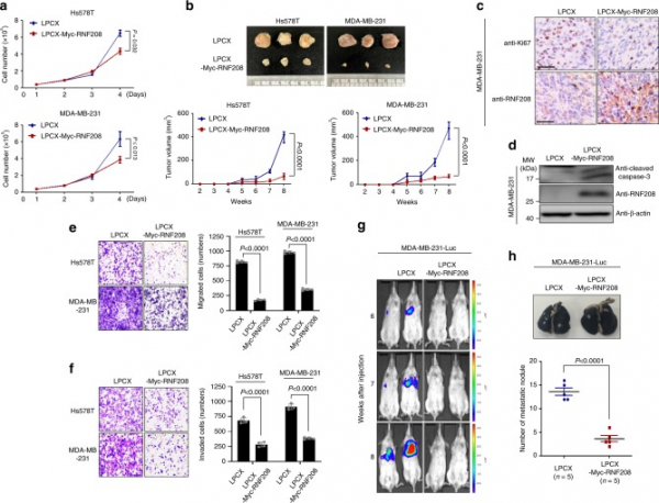 ▲RNF208 유전자의 TNBC 세포 성장 및 폐 전이 억제 효과(테라젠이텍스 발표 논문(Nature communications))