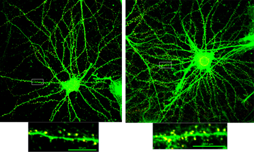 ▲ANL-101 투여 전/후 신경세포의 수상돌기 가시 수가 늘어난 현미경 사진. ANL바이오 제공.