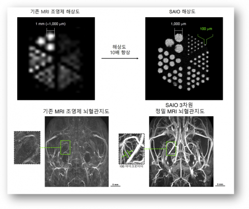 ▲기존 조영제와 비교한 ‘SAIO(사이오)’의 해상도(위), 3차원 MRI 뇌혈관지도(아래) (연세의료원 제공)