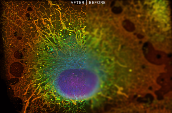 ▲엘리콘(Eikon)의 살아있는 세포에서 고해상도 관찰이 가능한 현미경 기술(좌), 기존 현미경 기술(우)