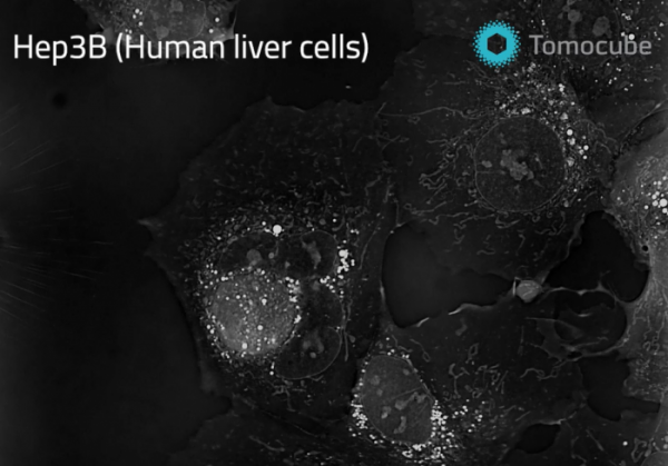 ▲HT-X1으로 측정한 세포내 미토콘드리아 움직임(https://www.youtube.com/watch?v=Ro0lHfByerw)