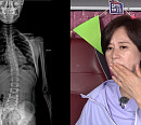 척추측만증에 좋은 자세 교정법ㆍ불면증 없애주는 꿀잠보장운동 소개(운동 맛집)