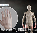 '명의' 이연아 교수가 전하는 류마티스 관절염의 원인 및 치료법