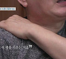 '명의' 김석우 교수가 전하는 목디스크와 경추척수증 증상 및 자가진단법