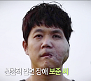 '사랑의 가족' 혈관종 뮤지컬 배우 보준 씨ㆍ발마사지 봉사 하는 공무원
