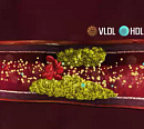 이해영ㆍ임수 교수가 전하는 대사증후군 극복법(생로병사의 비밀)