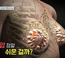 '명의' 박흥규 교수가 전하는 유방암의 모든 것