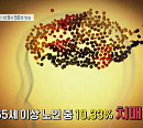 '명의' 문소영 교수가 전하는 치매 증상 및 치료제 아두카누맙