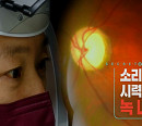 '생로병사의 비밀' 소리없는 시력 도둑 녹내장