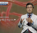 '명의' 최석근 교수가 전하는 뇌동맥류의 전조증상 및 치료법