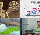 골다공증 예방법ㆍ골밀도 높이는 운동법 소개(생로병사의 비밀)