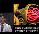 '생로병사의 비밀' 소혈관 질환의 모든 것