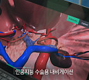 의료 AI가 가져오는 새로운 의료 변화(생로병사의비밀)