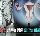 '생로병사의 비밀' 조기 발견 어려운 난소암