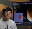 '생로병사의 비밀' 피부암 진단 앱ㆍ방사선 치료ㆍ인공지능 대장 내시경, 암에 맞서는 인공지능(AI)