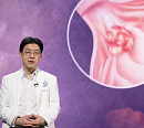 '명의' 정훈용ㆍ허훈 교수가 전하는 위암 판정, 그 이후 환자들의 삶