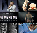 '명의' 진동규 교수가 전하는 고령 허리 질환과 허리 수술