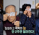 '생로병사의 비밀' 눈 나이 되돌리는 법