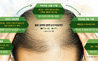 “급여 될까 안될까”…‘머리 빠지게’ 고민하는 정부[자라나라 머리머리]