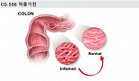 크리스탈, 염증성장질환 신약후보 발굴..특허 출원