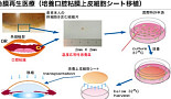 오사카대, 'iPSC 유래 각막조직' 최초 이식..