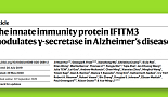 선천면역 'IFITM3', 신경염증→Aβ 생산 '연결고리' 밝혀져