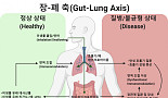 [BioS 레터]장-폐축, '코로나19'와 마이크로바이옴