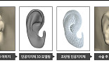 티앤알바이오팹, '귀 재건용 인공지지체' 환자에 이식