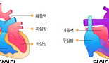단심실 환자, 폰탄수술, 그리고 '유데나필'의 가능성