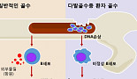 고령화의 그늘...다발골수종, 20년간 30배 증가