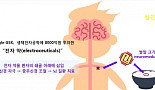 약물 아닌 전기자극으로  '모든 신경질환 정복' 나선 기업들