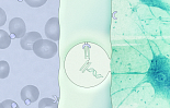 애르스카, 시드 2100만弗..뇌질환 ‘BBB 셔틀’ RNAi