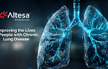 알테사, 시리즈B 7500만弗..'COPD 항바이러스제' 개발