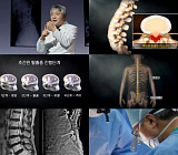 '명의' 진동규 교수가 전하는 고령 허리 질환과 허리 수술