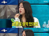 '라디오스타' 소유 "성형 전-후 차이없더라" 고백