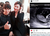 김미려♥정성윤, 둘째 생겼다…임신 13주 차