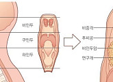 김우빈이 투병중인 비인두암은?