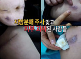 '제보자들' 지방분해 주사 맞고 피부 괴사 마이코박테리아 감염? "검게 변해버린 내 피부를 돌려주세요"