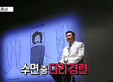 EBS '명의' 조진현 교수가 전하는 하지정맥류ㆍ동맥경화증 등 다리 혈관 질환 증상 및 치료법
