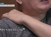 '명의' 김석우 교수가 전하는 목디스크와 경추척수증 증상 및 자가진단법