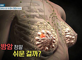 '명의' 박흥규 교수가 전하는 유방암의 모든 것