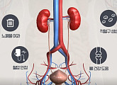 콩팥(신장) 위한 저염식의 중요성 및 건강한 생활 습관(생로병사의 비밀)