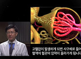 '생로병사의 비밀' 소혈관 질환의 모든 것